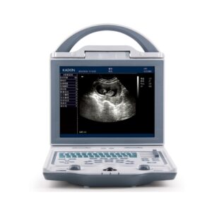 Rechargeable Human Ultrasound Scanner -KX5600