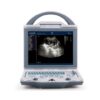 Rechargeable Human Ultrasound Scanner -KX5600