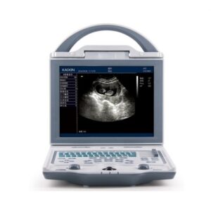 Rechargeable Human Ultrasound Scanner -KX5600